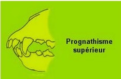 prognathisme-superieur